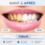 Charger l'image dans la galerie, Serum de blanchiment des dents
