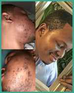 Charger l'image dans la galerie, CRÈME RÉPARATRICE DE PEAU
