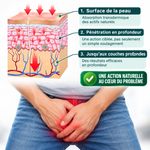 Charger l'image dans la galerie, Soulagez l'inconfort de la prostate sans effort - Appareil d'acupression pour soins de la prostate
