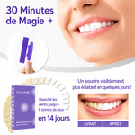 Charger l'image dans la galerie, Bandes de Blanchiment Dentaire 3D
